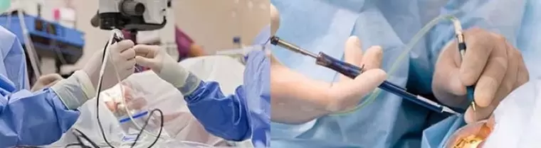 Operācija redzes atjaunošanai